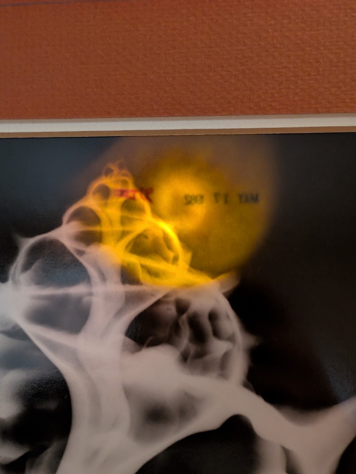 William A. Conklin 1978 Radiographic Photograph Murex Shell — Signed, #39/500