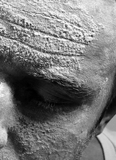 Author’s Photo – “Statue” Stone, Face Self Portrait Passe-Partout 18x24cm